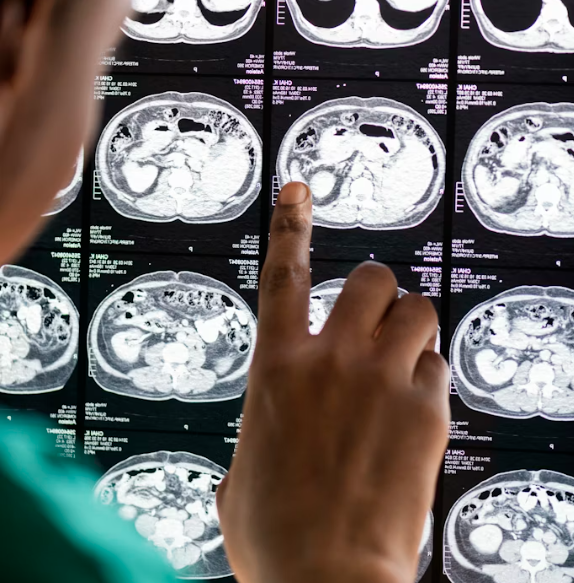 Best Mri Doctor in Najafgarh